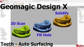 Geomagic Design X   Teeth Auto Surfacing