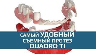 Съмные зубные протезы: съемный зубной протез Quadro Ti