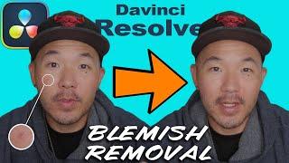 Davinci Resolve Blemish & Pimple Removal Tutorial. Easy Guide For Clearer Skin In Your Videos!