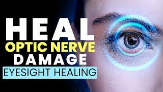 Eyesight Healing Frequency | Heal Optic Nerve Damage | Get Relief from Eye Strain Fast | 528Hz Music