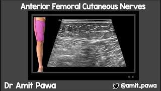 Anterior Femoral Cutaneous Nerve Block