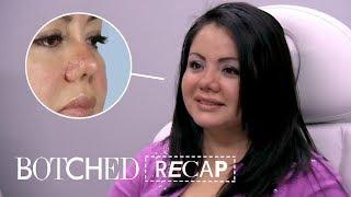 Lipo Patient Gets Surprise Piggy Nose Instead | Botched Recap (S5 E10) | E!