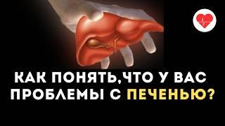 5 признаков которые указывают на проблему с печенью!