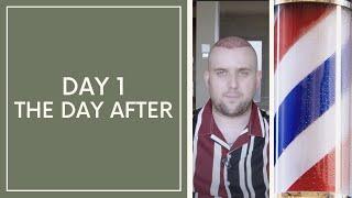 THE MORNING AFTER THE HAIR TRANSPLANT BEFORE DAY 1 : MEDAWAY COSMETICIUM