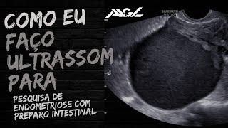 Como eu faço Ultrassom para pesquisa de endometriose com preparo intestinal - Palestra para médicos