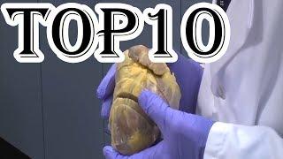 Top 10 Most Expensive Medical Treatments