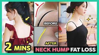 2 MINS NECK HUMP REMOVAL EXERCISES | Correct Neck hump fat loss, Get rid of Buffalo hump