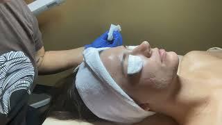 Glycolic Chemical Peel #1 (Nikki Duaban)