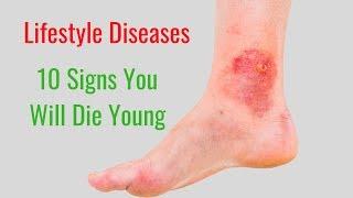 10 Signs You Will Die Young - Genetics and Inheritance, Lifestyle Diseases