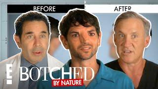 No Nose? No Problem! FULL TRANSFORMATION | Botched By Nature | E!