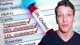 LDL Cholesterol level: Your lab results explained