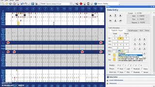 Charting Furcations and Mobility in Dentrix