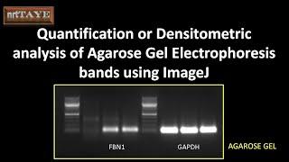 Quantification or densitometric analysis of agarose gel electrophoresis bands using ImageJ