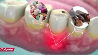 How Colgate Pain Out Works