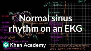 Normal sinus rhythm on an EKG | Circulatory System and Disease | NCLEX-RN | Khan Academy