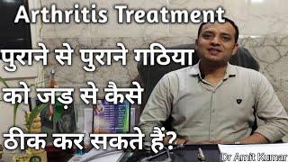 Arthritis | गठिया को जड़ से ठीक करें।पुराने से पुराने गठिया को जड़ से ठीक करें।Arthritis Treatment