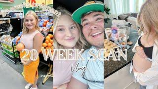 COME WITH US TO OUR 20 WEEK SCAN | BABY GIRL | The Basham Family