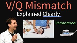 VQ Mismatch - Ventilation Perfusion Mismatch & Ratio (Remastered)