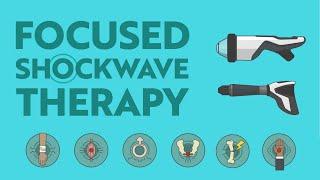 Focused Shockwave Therapy - What is it & How Can it Help?