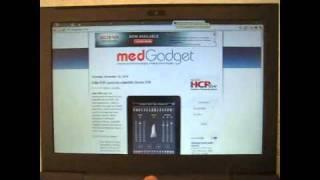 Google CR48 Review by Medgadget