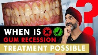 Gum Recession - Is there a cure?