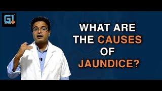 What are the causes of Jaundice?