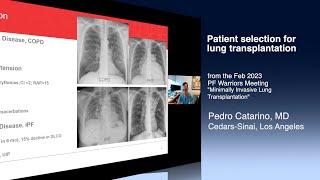 Patient selection for lung transplantation, a Meeting Moment from PF Warriors