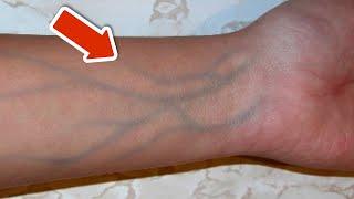 5 signs of poor circulation that you should NEVER ignore(IMPORTANT)