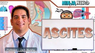 Ascites | Clinical Medicine