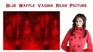 Blue Waffle Vagina - VAG