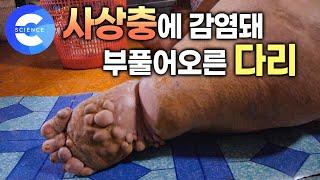 야외에서 일하고 왔을 뿐인데 다리가 부풀어올랐다 | 역시 또 모기였어 | 전염병 매개체 '모기' | 다큐프라임