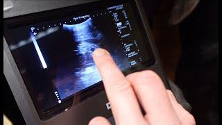 Ultrasound Hacks: Pregnancy scanning goats, sheep, cows and horses all with the same probe!