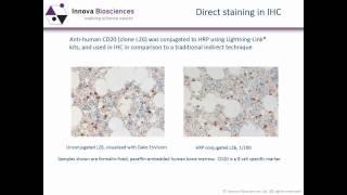 Immunohistochemistry Webinar: An Introduction to Immunohistochemistry