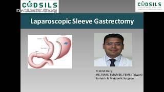 SLEEVE GASTRECTOMY ANIMATION I DR AMIT GARG I BEST SURGEON FOR SLEEVE IN INDIA I WEIGHT LOSS SURGERY