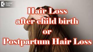 Hair loss after childbirth | Postpartum Hair Loss - Rincy Sara Samuel