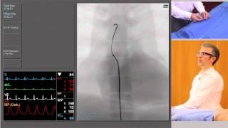 Catheterisation Left and Right Coronary Arteries