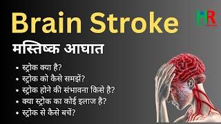 Brain Stroke, Stroke causes, Stroke symptoms, Stroke treatment, Stroke diet, Stroke diagnosis,