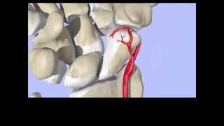 Blood Supply to the Scaphoid