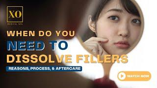 When to Dissolve Fillers: Reasons, Process, and Aftercare // XO Medical Spa