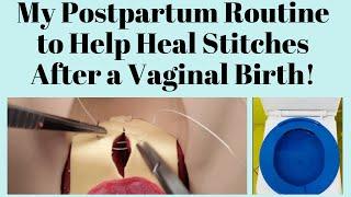 My Postpartum Routine to Help Heal Stitches After a Vaginal Birth !