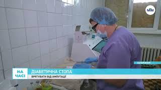 На часі - Діабетична стопа: порятунок від ампутації у лікарні №4. - 13.01.2025