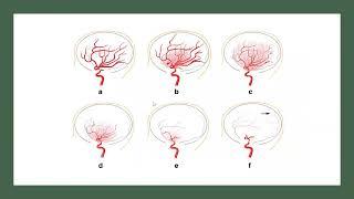 Neuro rounds MMD