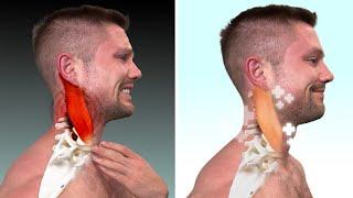 This Will Fix Your Tight Neck Way More Than Stretching