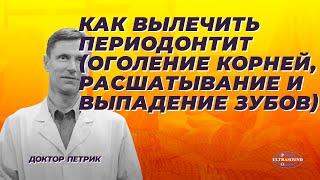 Как вылечить периодонтит( оголение корней, шатание и выпадение зубов). Перспективное исследование.