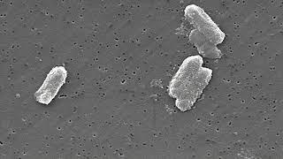 This Makes Bacteria So Dangerous - Biofilms!