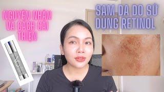 Sạm da khi sử dụng retinol|Nguyên nhân và Xử lý| Huỳnh Thuyên