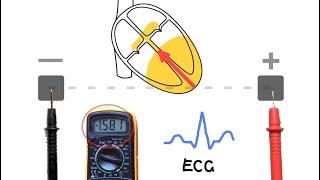 ECGs - How they work