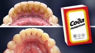 Старый стоматолог: Зубной камень и налет легко можно убрать в домашних условиях!