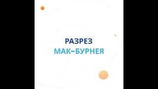 Разрез Мак-Бурнея