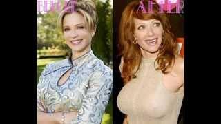 lauren holly plastic surgery